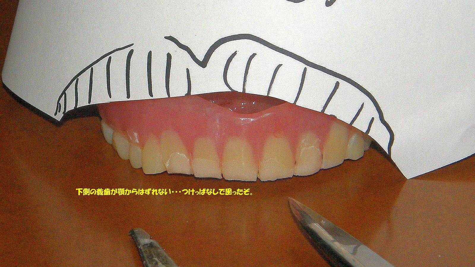 下側がとれないぞ！