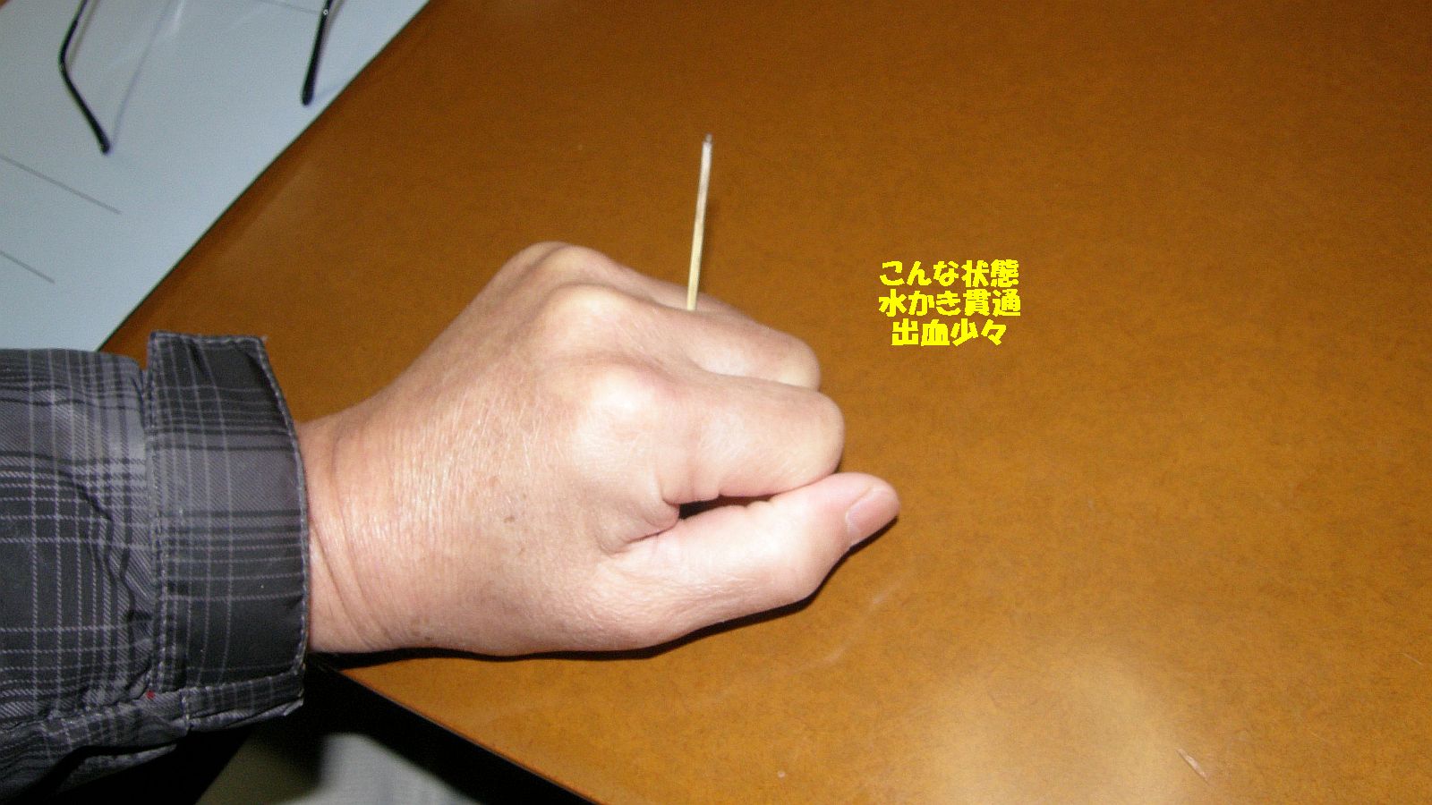 血が滲んでいるぞ！